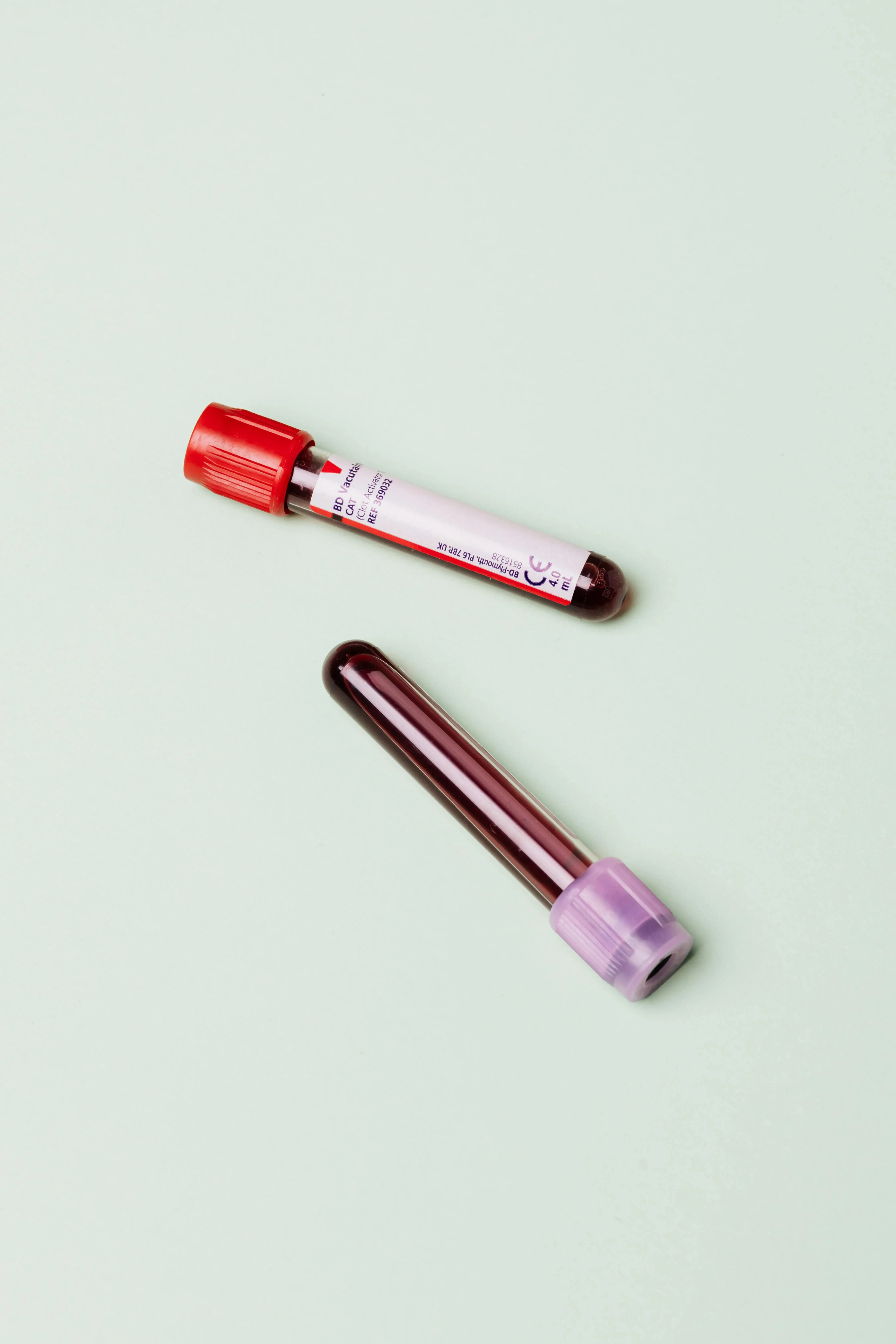 Laboratorio transfusional de Hemolife analizando muestras con tecnología NAT